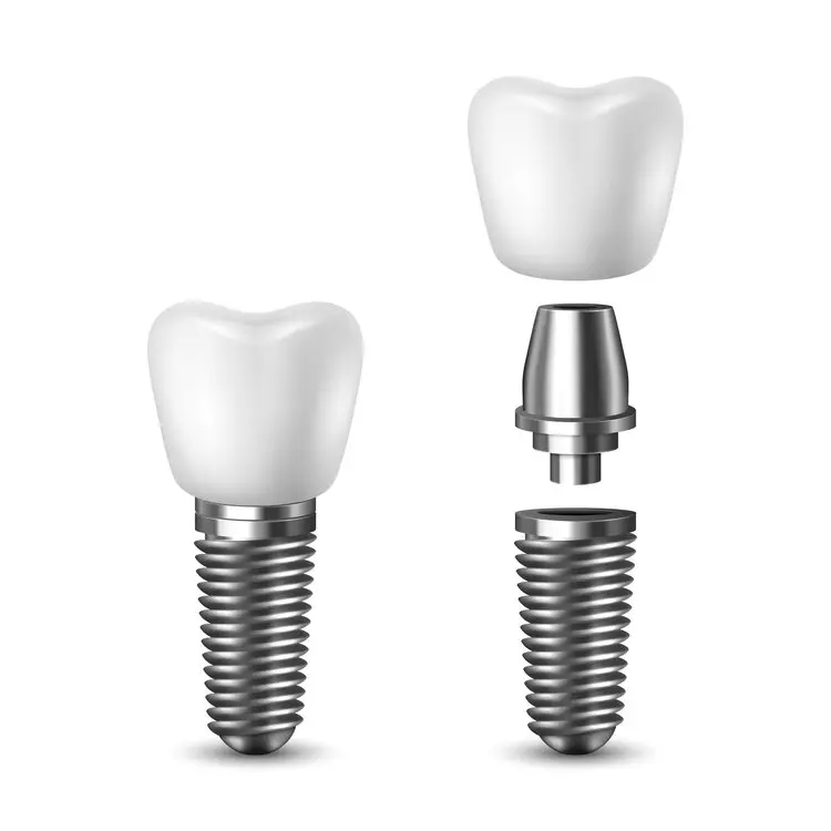 a dental implants with a crown