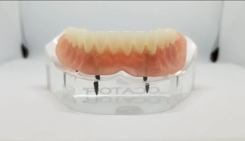 a plastic model of teeth